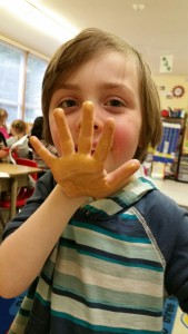 The 'Golden Touch'